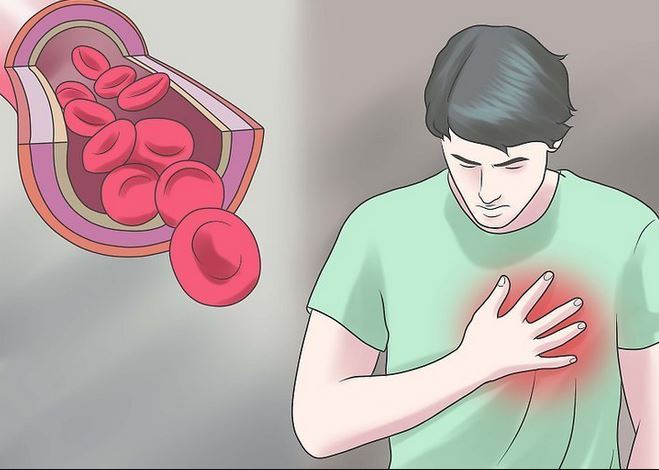 Bác Sĩ Giải Đáp Băn Khoăn: Tức Ngực Khó Thở Là Bệnh Gì?