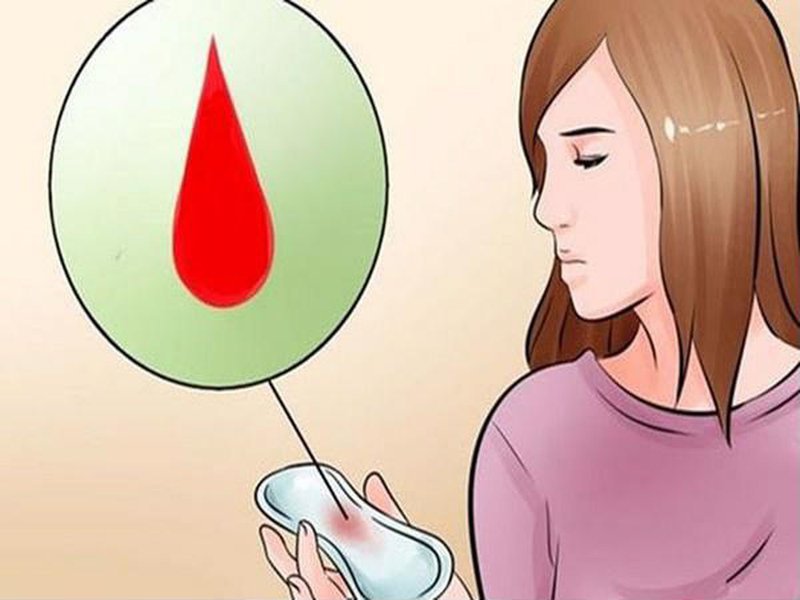 Xử Trí Những Rối Loạn Kinh Nguyệt Ở Tuổi Dậy Thì