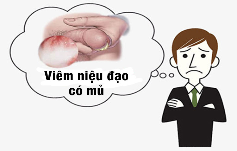 TÁC HẠI NGUY HIỂM KHI MẮC BỆNH VIÊM NIỆU ĐẠO